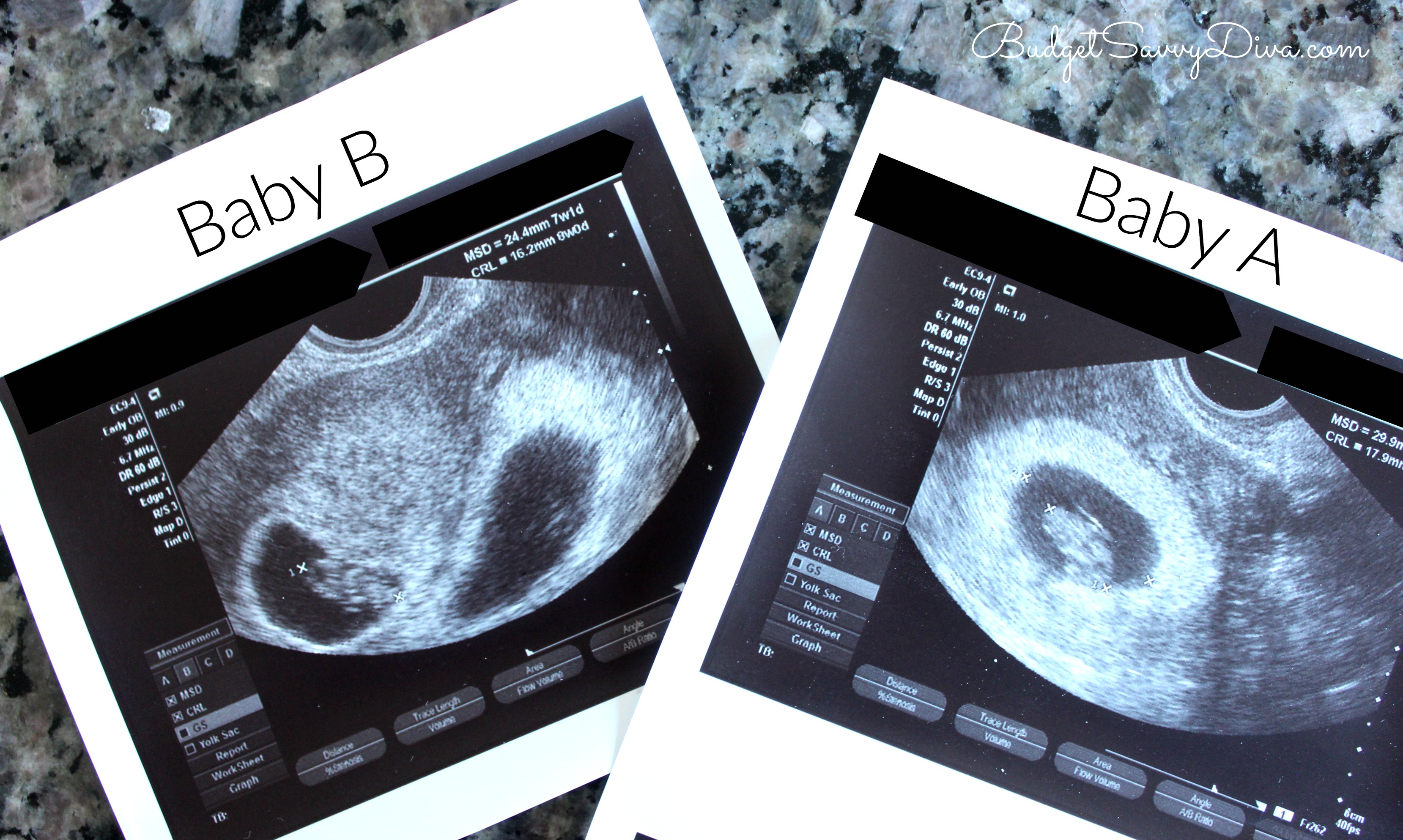 8 Weeks Pregnant With Twins Update | Budget Savvy Diva