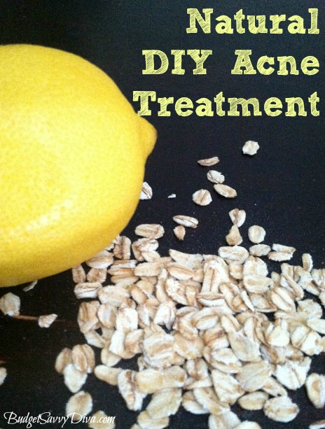 How to Make a Natural DIY Acne Treatment Budget Savvy Diva