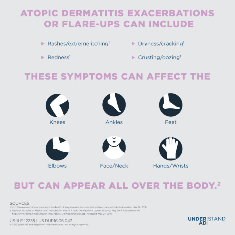 symptoms-infogram