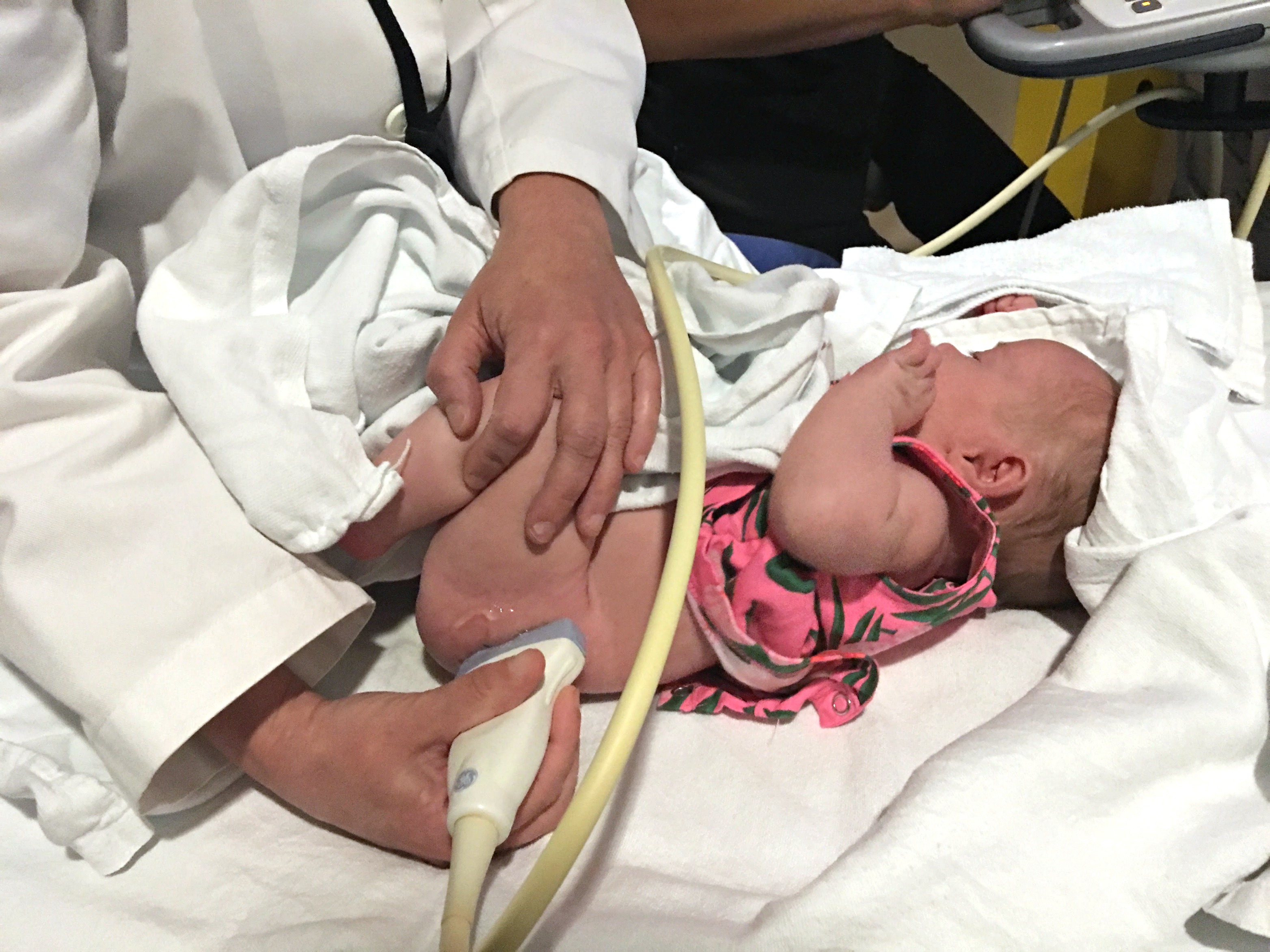 newborn-twin-ultrasound-for-hip-dysplasia-budget-savvy-diva