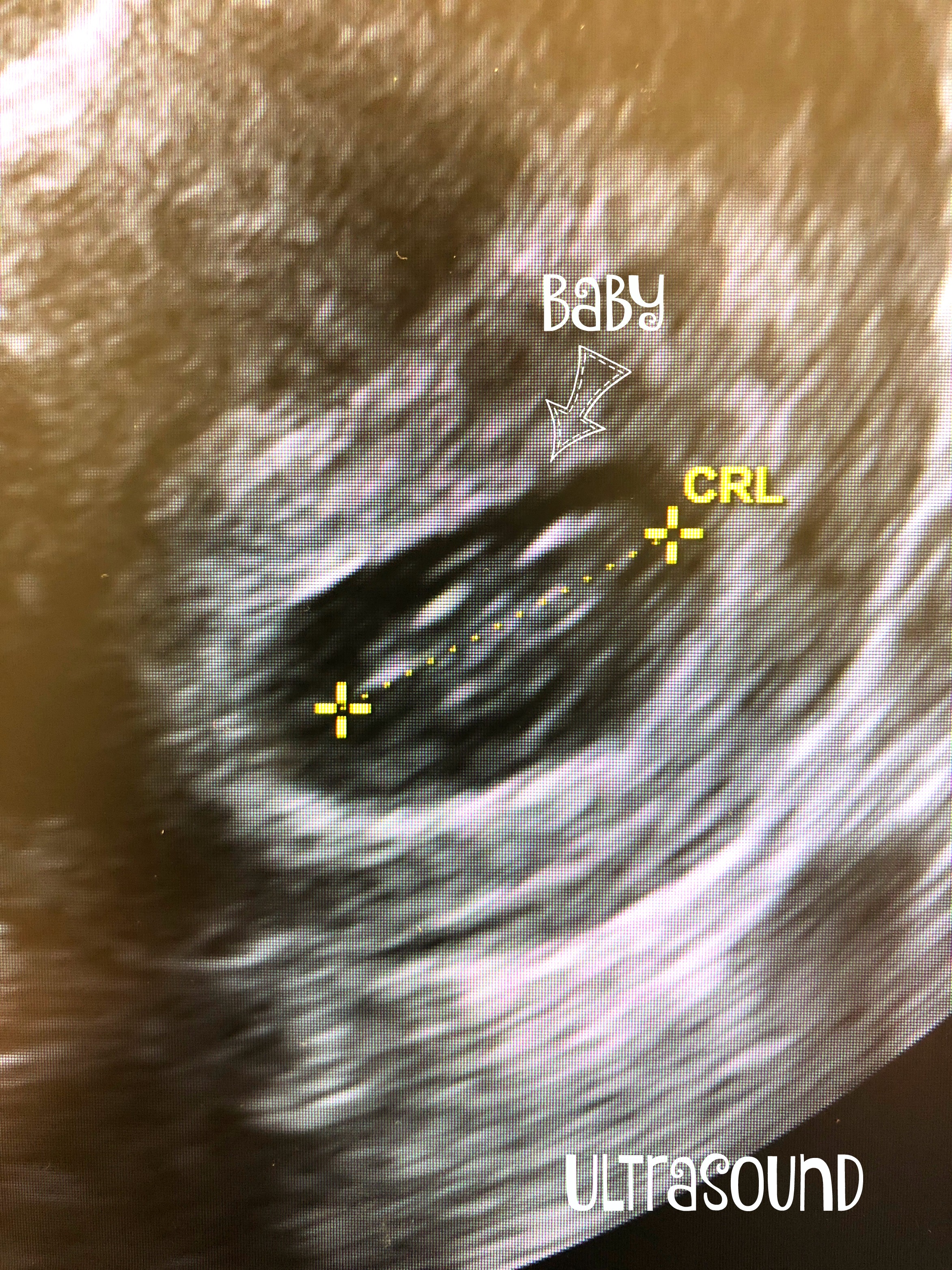 week 7 pregnant